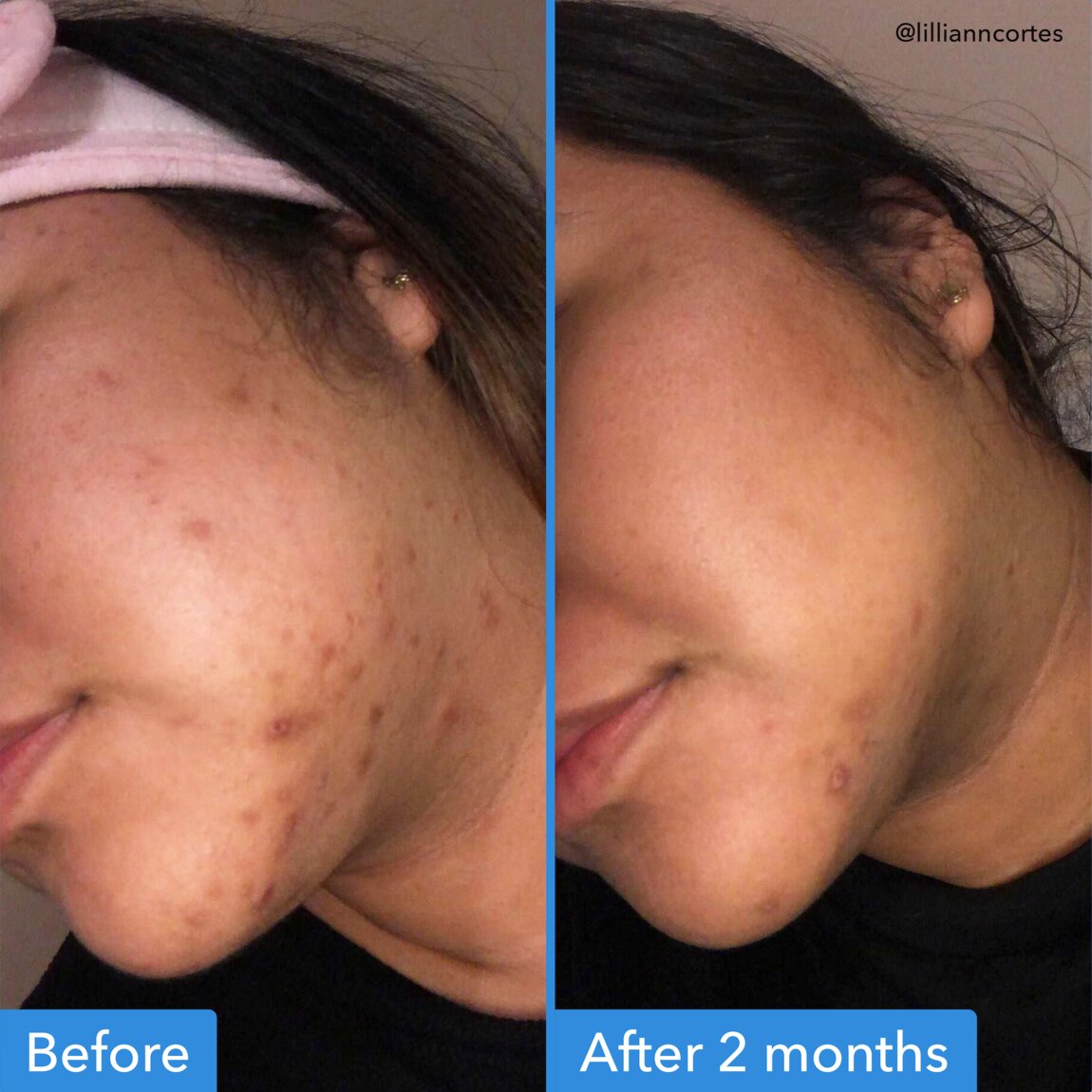 discoloration-correcting-serum-v7 zb_p.jpg