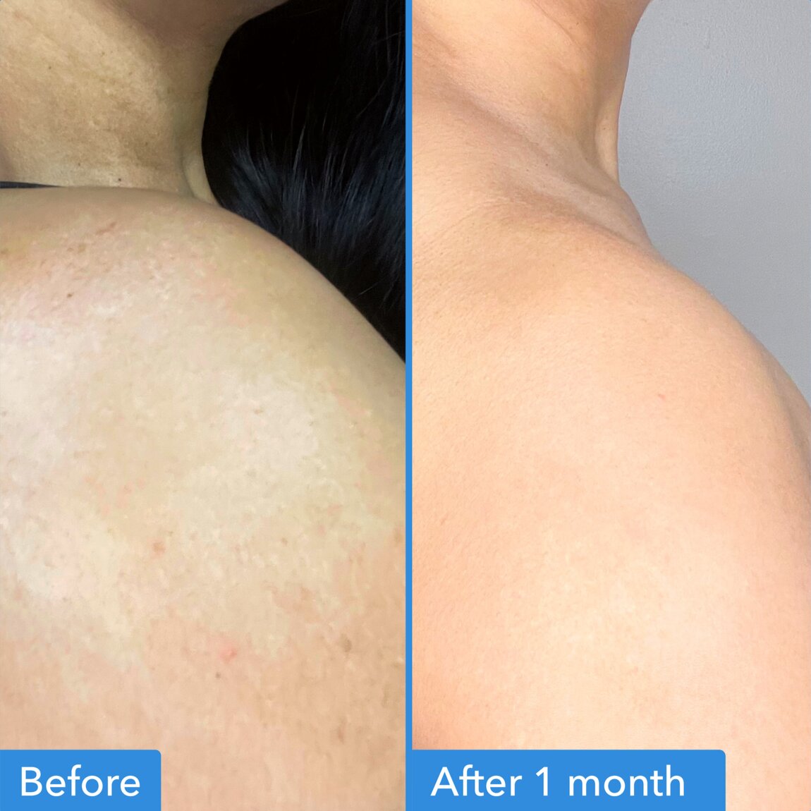 discoloration-correcting-body-treatment-w7 zb_p.jpg