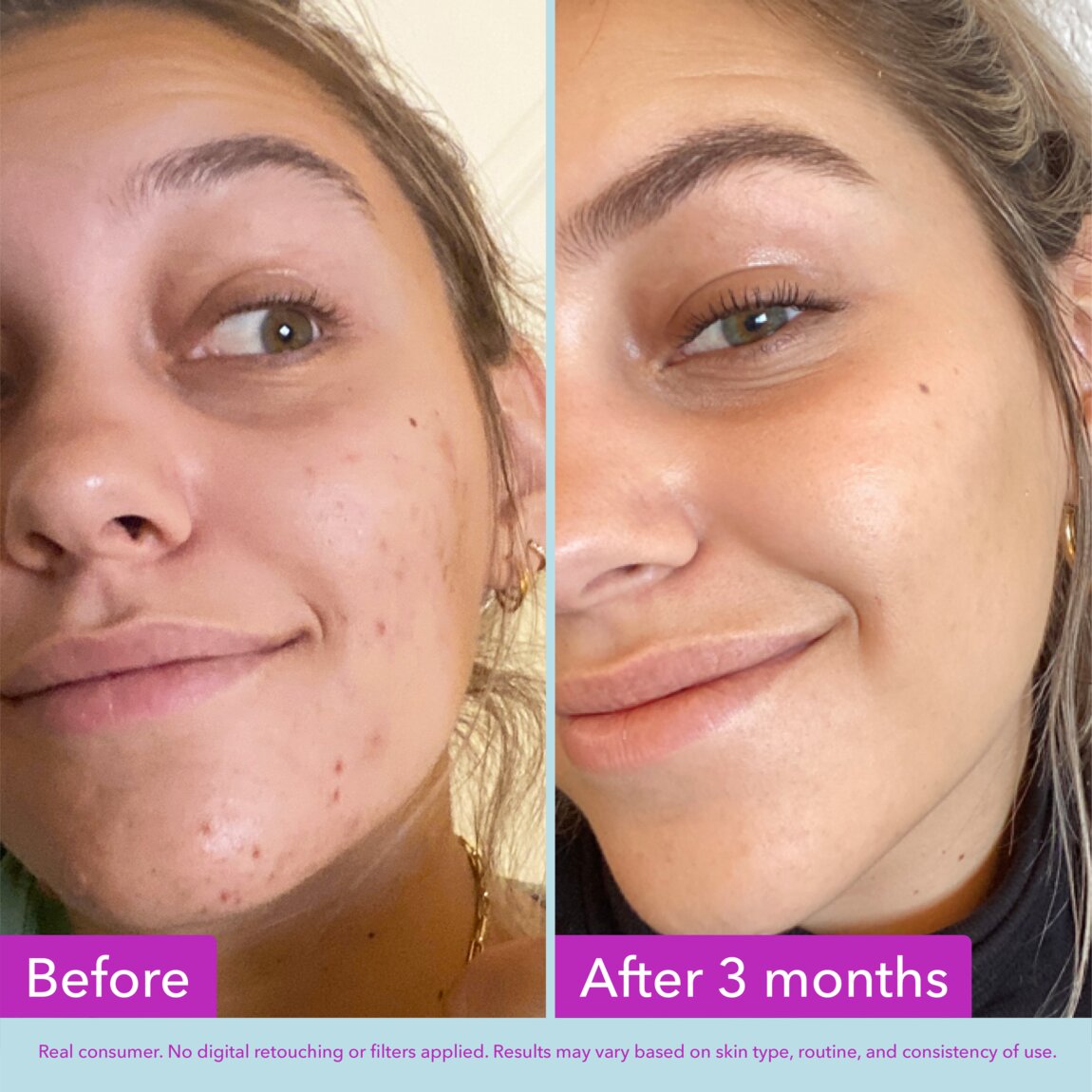 niacinamide-brightening-toner-t7 zb_p.jpg
